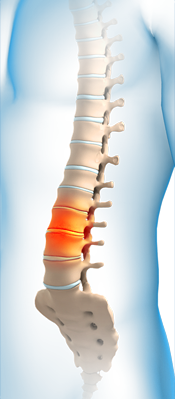 Complete Spine Care