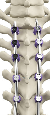Complete Spine Care